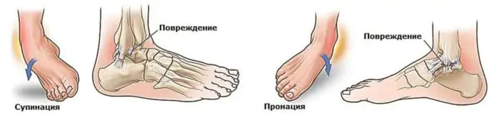 Где находится лодыжка у человека фото Где находится лодыжка у человека фото