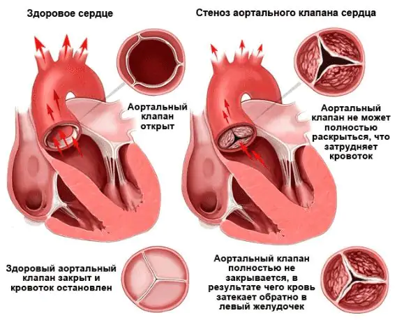 Сердце человека: анатомия, функции и работа клапанов